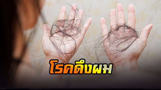 โรคดึงผม โรคดึงผม