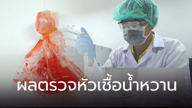 ผลตรวจหัวเชื้อน้ำหวาน ผลตรวจหัวเชื้อน้ำหวาน