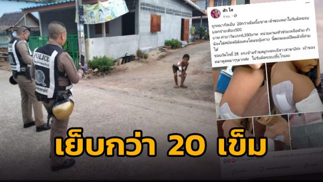 เย็บกว่า 20 เข็ม