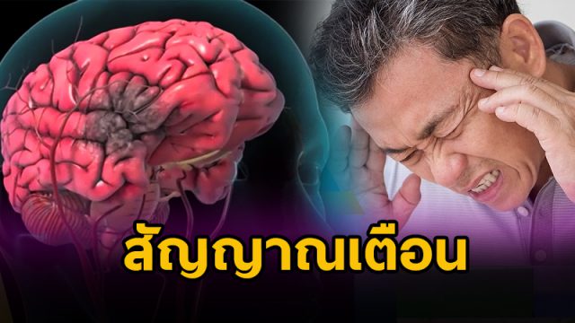 โรคหลอดเลือดสมอง โรคหลอดเลือดสมอง